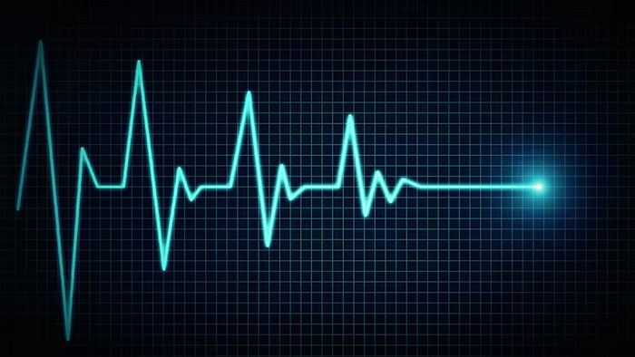 Un electrocardiogramme indiquant la mort.
